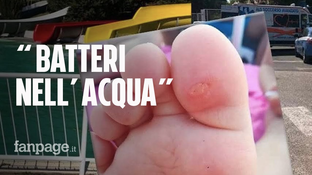 Pareo Park chiuso dopo le analisi per manutenzione. L'Asl conferma: 