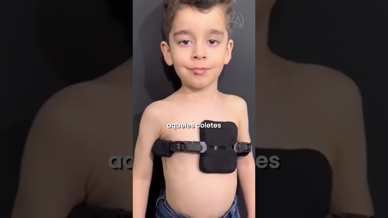 SEU FILHO TEM PECTUS CARINATUM?