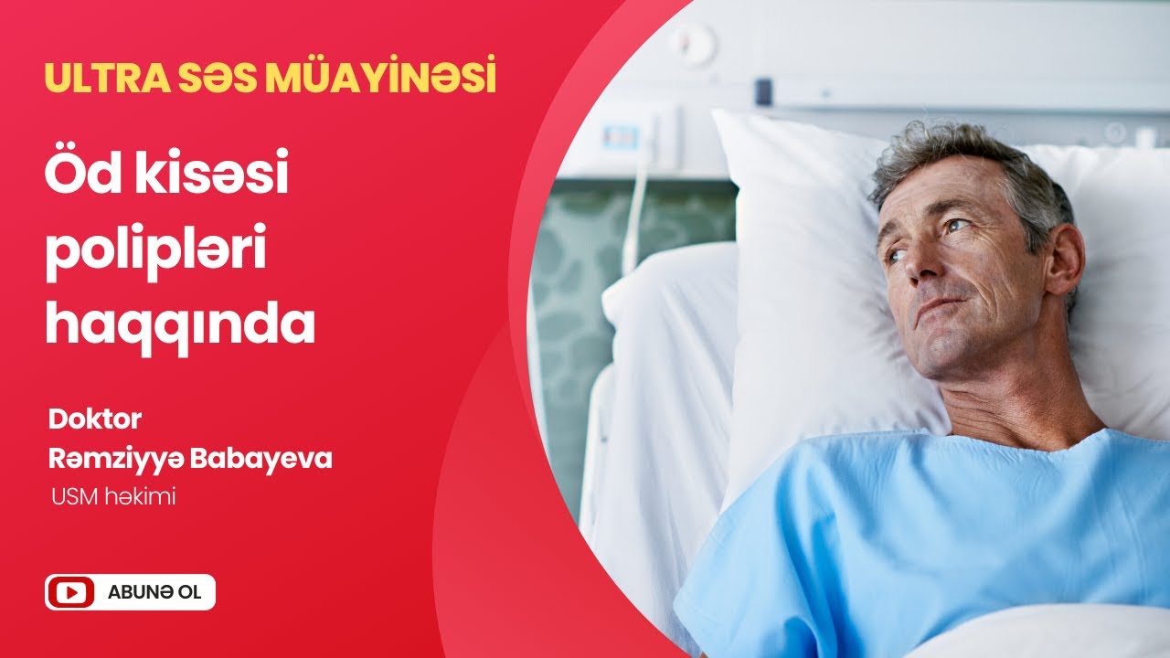 Öd polipləri haqqında #aysmed #aysmedklinika