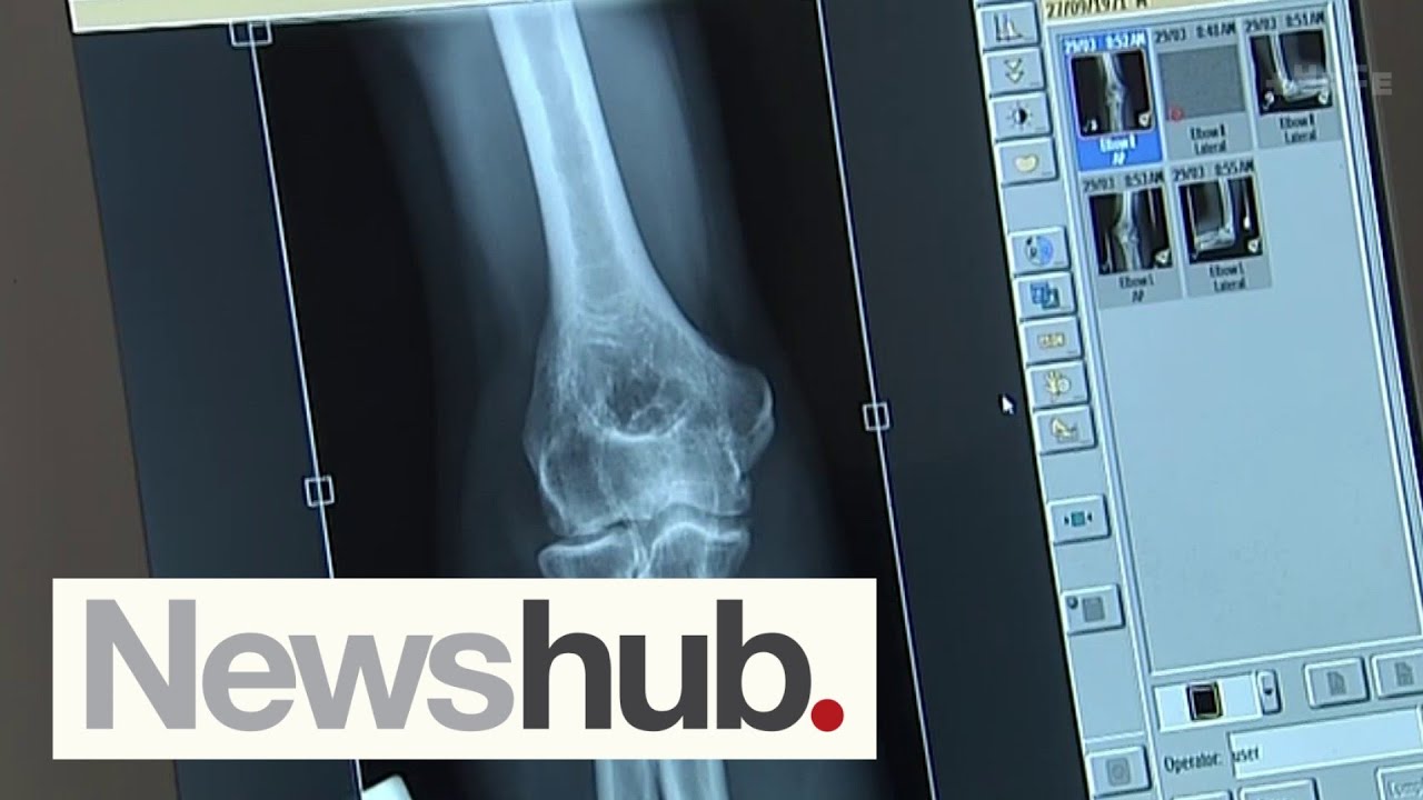 Staff shortages at radiology departments across NZ could cost lives, Cancer Society warns | Newshub