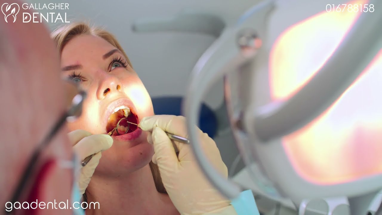 Treatments for Missing Teeth Dublin 2 - Gallagher Dental