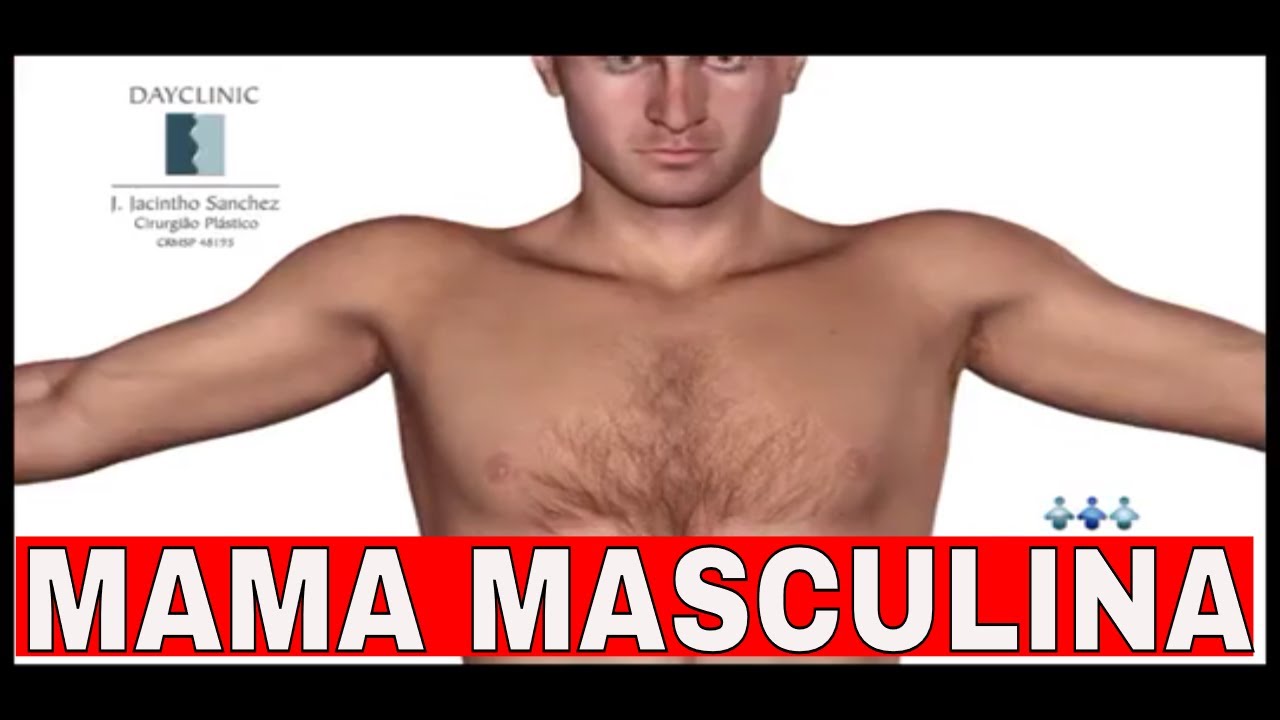 MAMA MASCULINA - Tudo que você precisa saber | Cirurgia Plástica