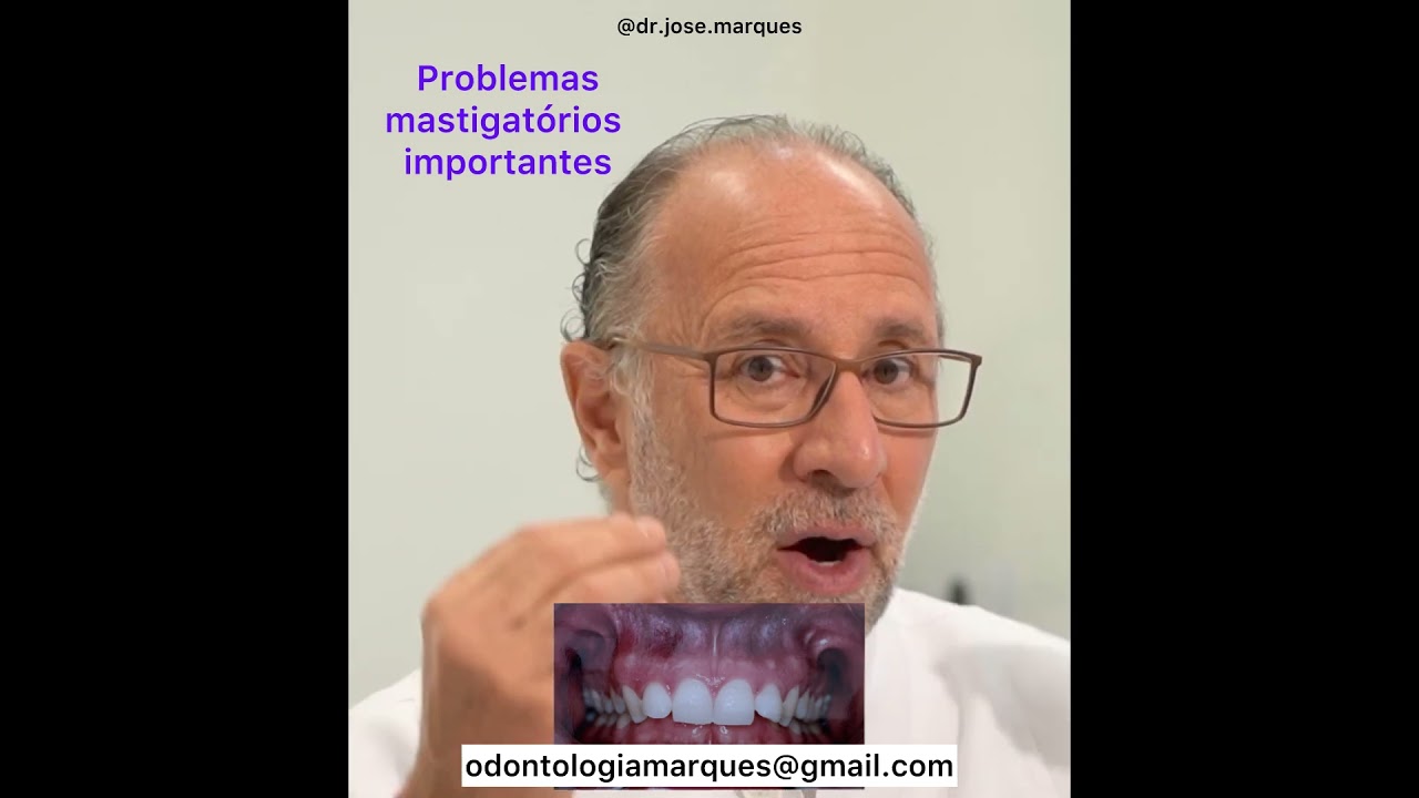 SOBREMORDIDA