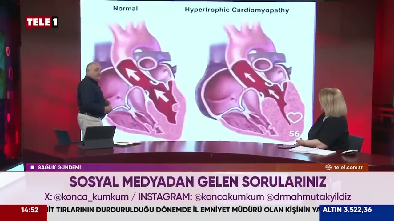 Kalp kası kalınlaşması..