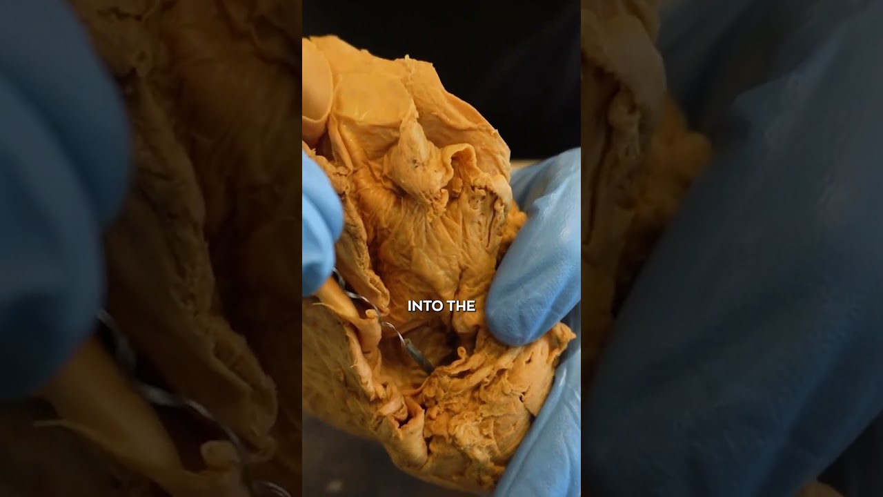 Crazy Things Found In Dead Bodies