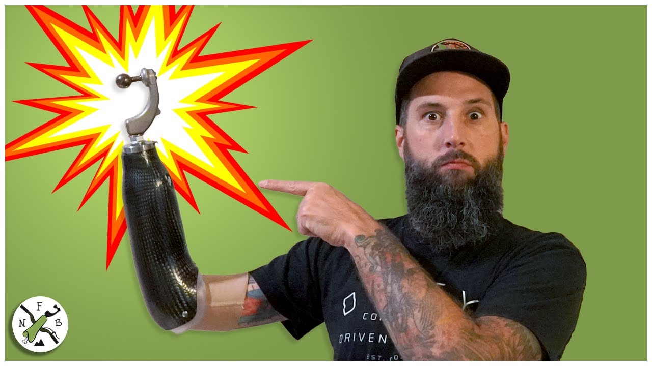 How Much Did My Prosthetic Arm Really Cost?! 💰💰💰