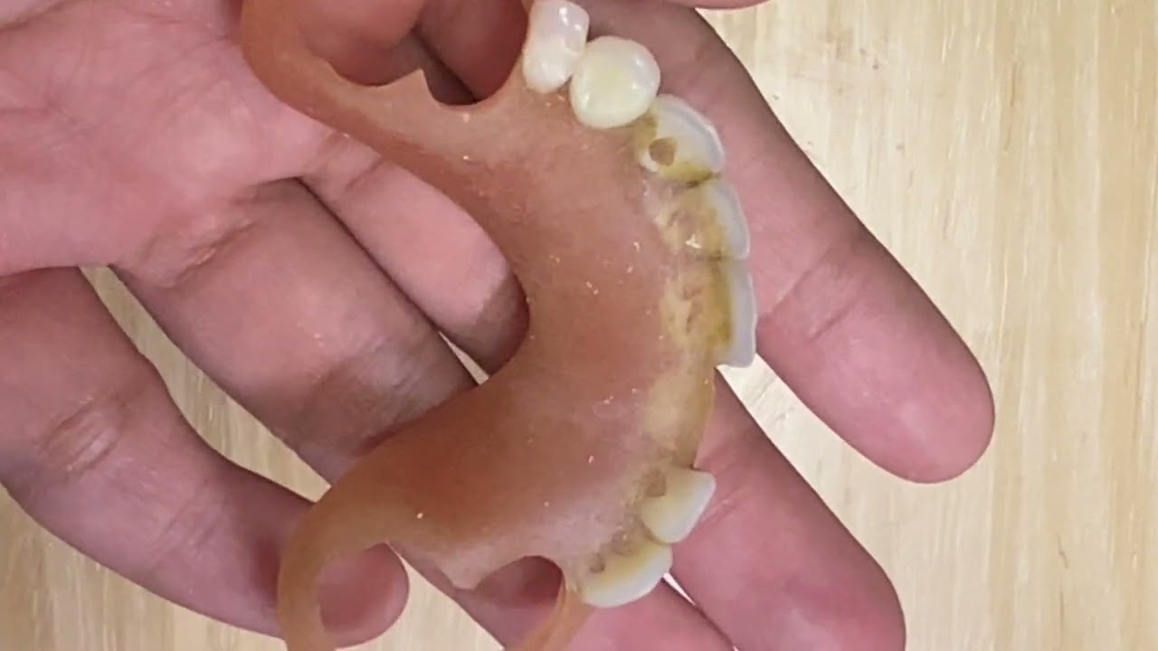 V&igrave; sao Thư sợ h&agrave;m nhựa dẻo? :((