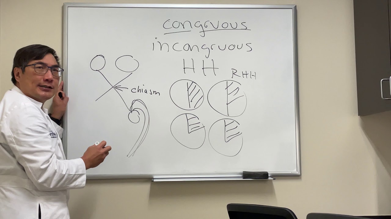 Congruous vs. incongruous homonymous hemianopsia