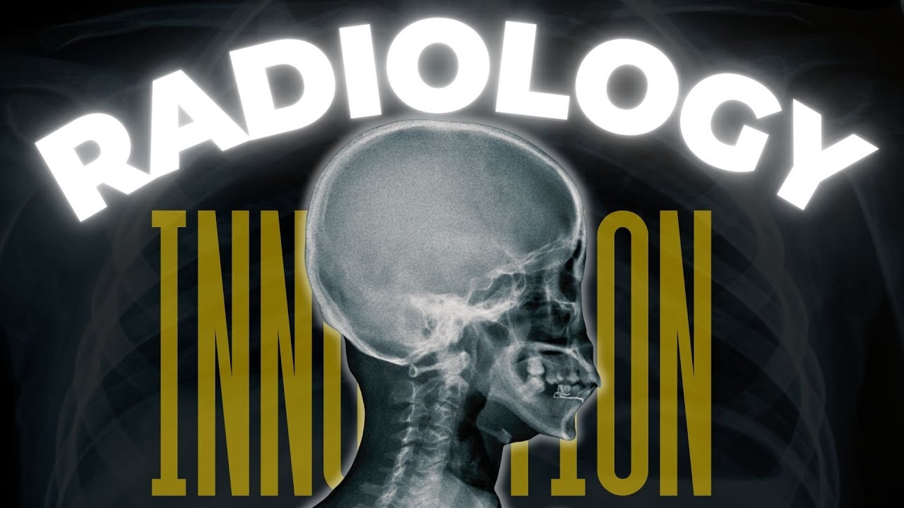 Advances in Radiology: IRIA & AOCR 2025