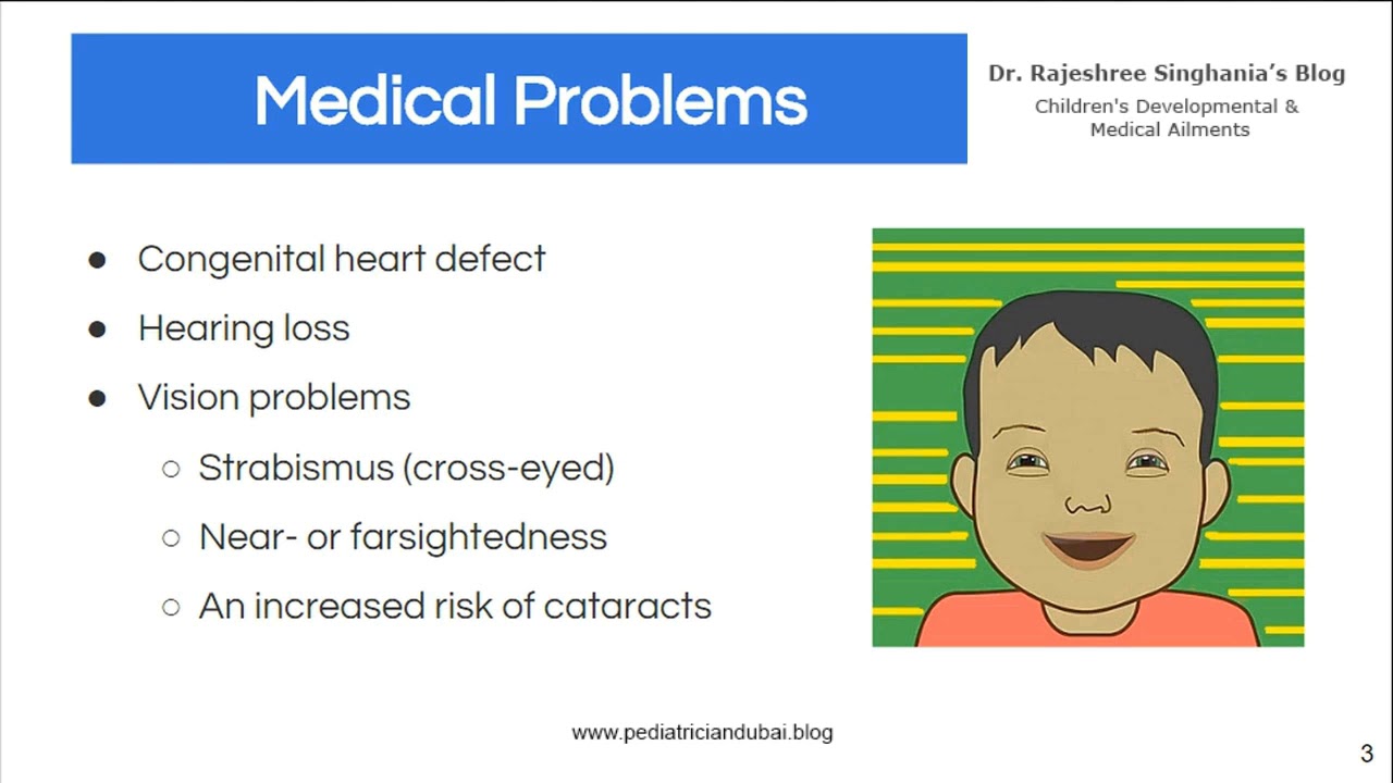 Down Syndrome Baby Dubai | This Syndrome Affects Child&rsquo;s Mental & Physical Development