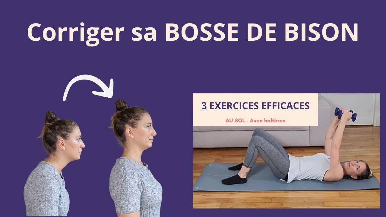 3 exercices pour corriger la BOSSE DE BISON