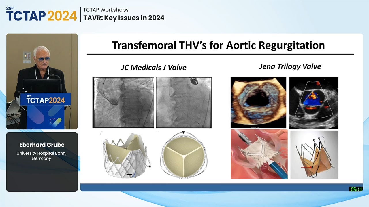 [TCTAP 2024] TCTAP Workshops - TAVR: Key Issues in 2024