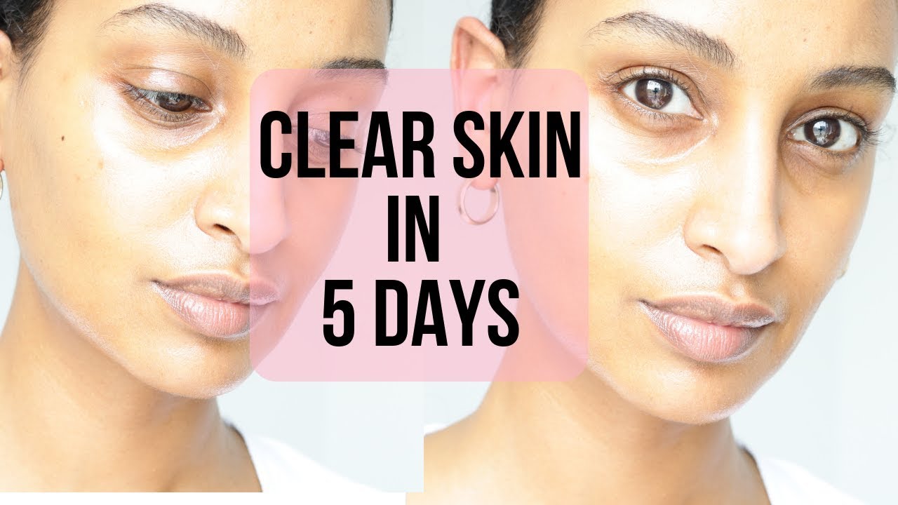 CLEAR GLOWING SKIN w/ Sweet Almond Oil| Segen Misghina