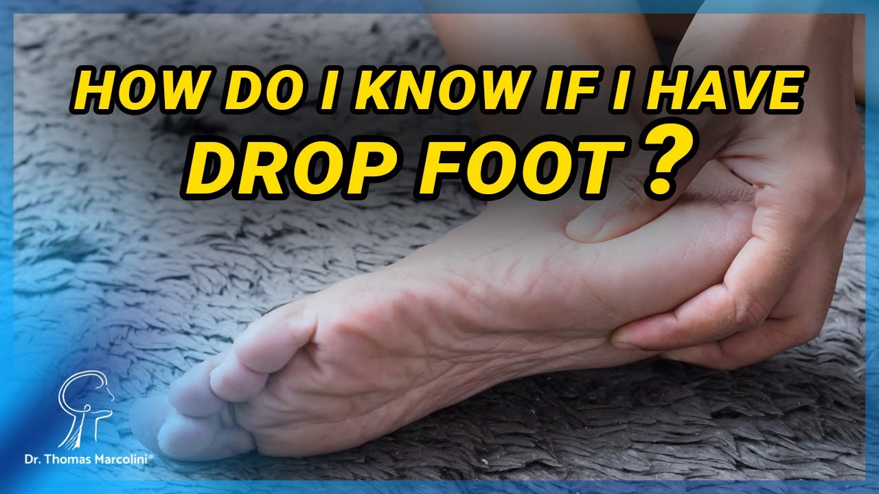 What are the symptoms of Foot Drop Syndrome?