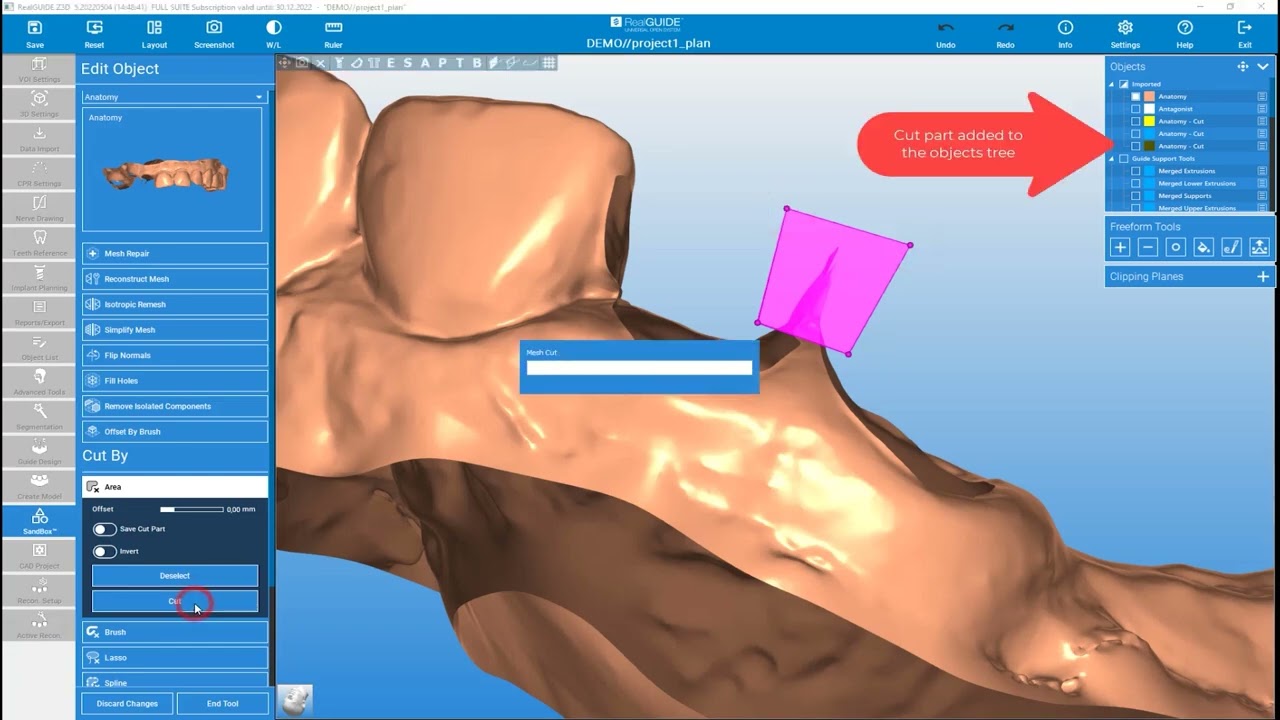 RealGUIDE Software:  Edit Object