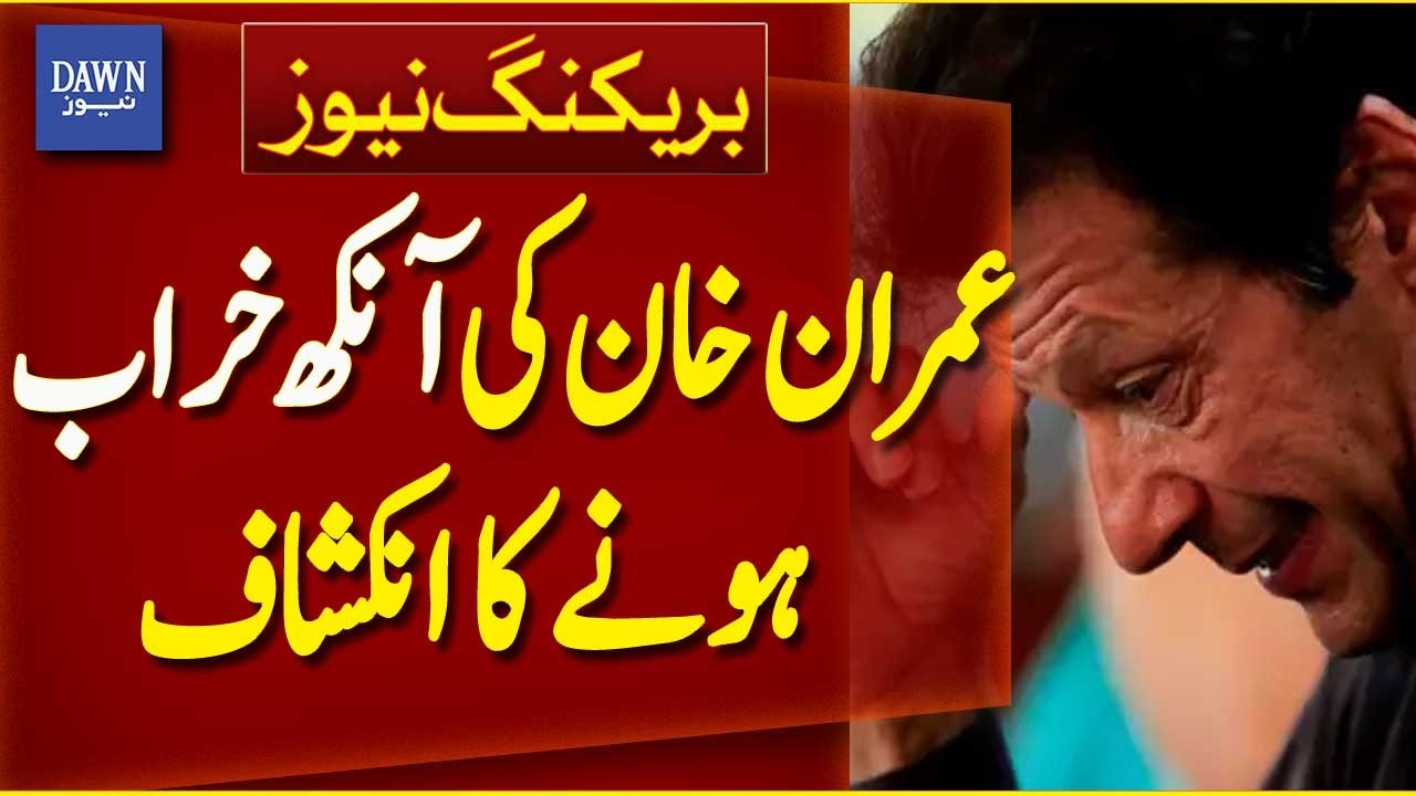 Shocking Revelation: Imran Khan&rsquo;s Eye Problem Exposed | Breaking News | Dawn News