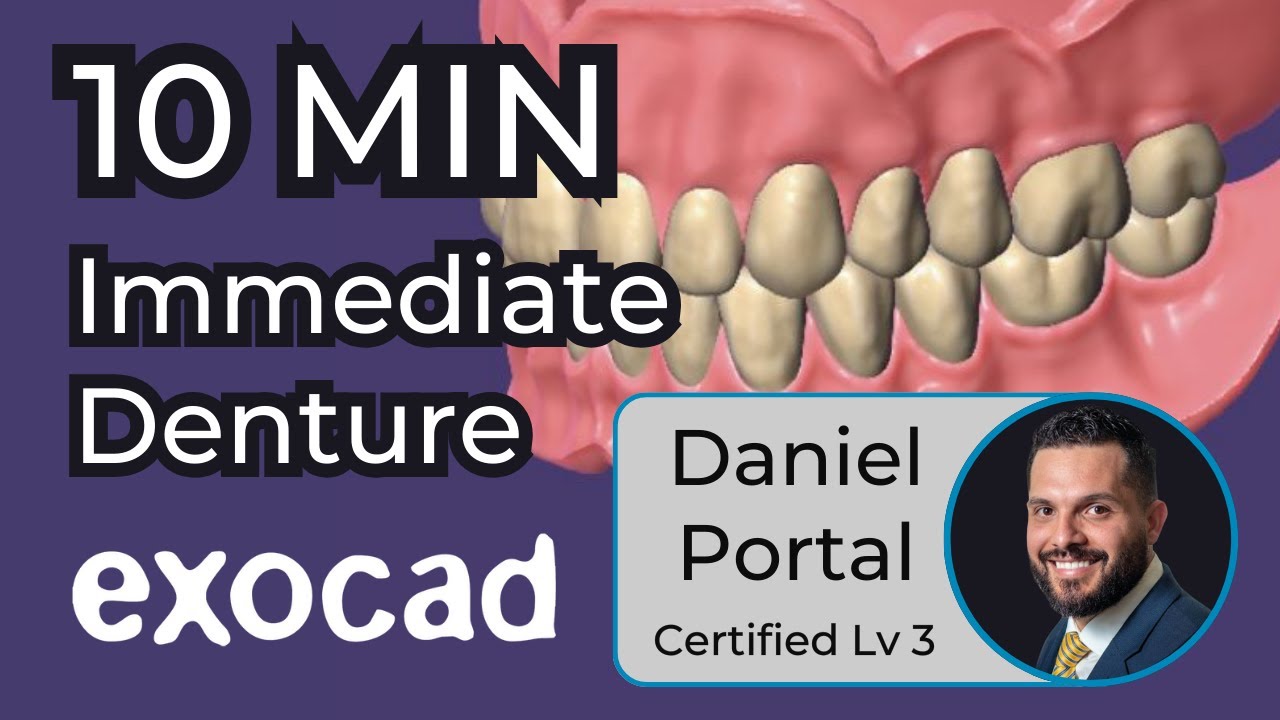 10 Minute Immediate Denture Design in exocad with Daniel Portal - ep #0011