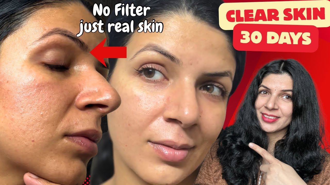 BEST MOISTURISERS that Repaired my DAMAGED SKIN BARRIER - Honest Review 2025