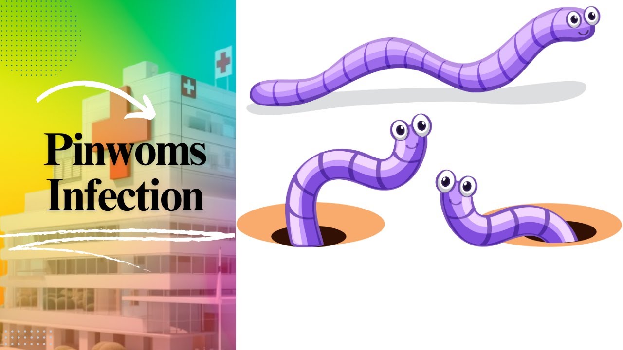 Pinworm Infections in Children | English-French Medical Interpreting Roleplay