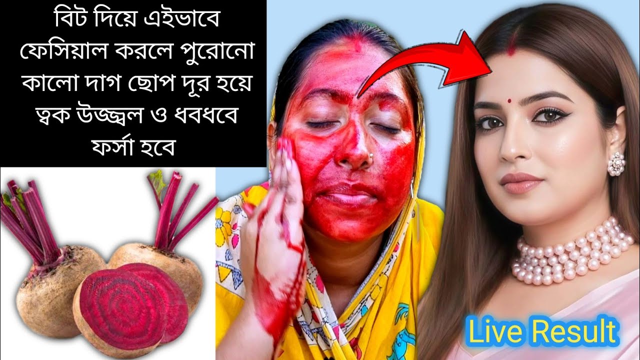বিটরুট সঠিক পদ্ধতিতে ব্যাবহার করুন, কালো দাগ ছোপ উঠে ত্বক হবে উজ্জ্বল ও গ্লোয়িং | Beetroot Facial 