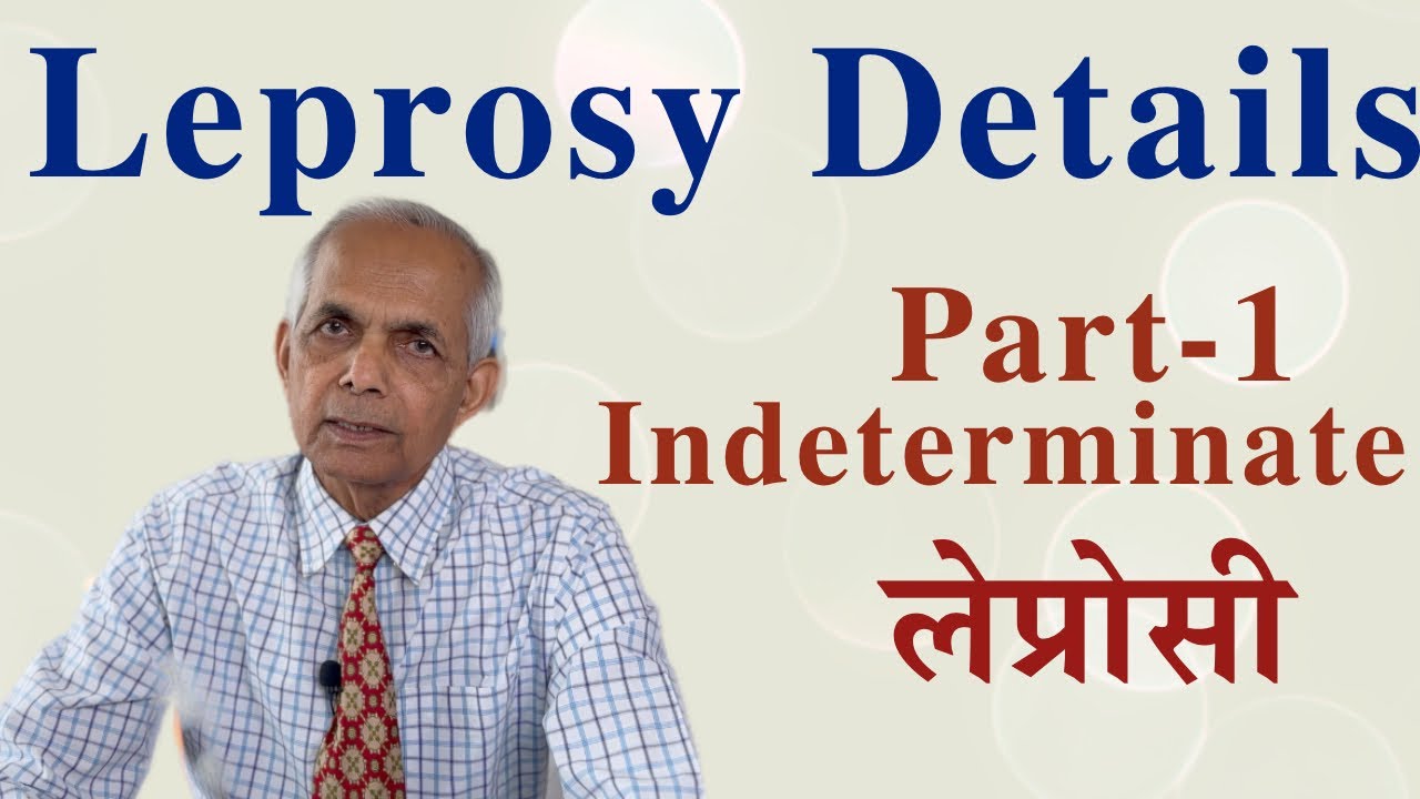 Leprosy indeterminate. Cause, symptoms & treatment. लेप्रॉस जानकारी डिटेल में