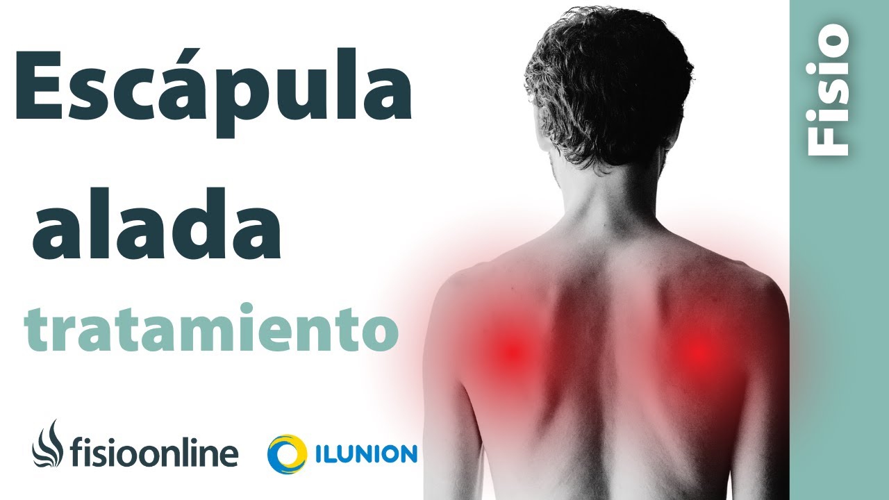 Escápula alada: causas, síntomas y soluciones