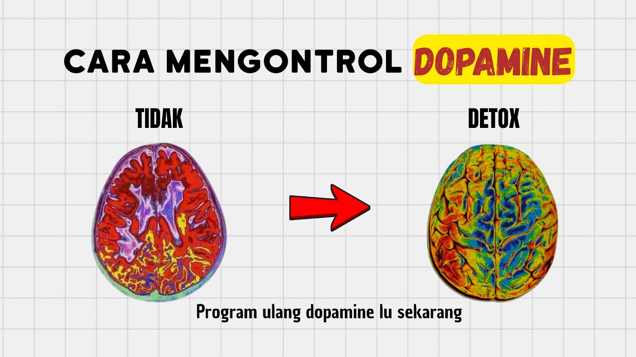RESET OTAK DALAM 11 MENIT, Begini Cara Rahasia Kendalikan Dopamine Kamu Untuk Bisa Fokus Total