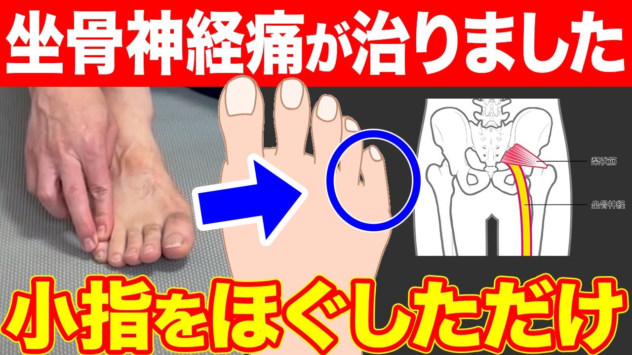 【衝撃】坐骨神経痛は小指が原因！太ももに走る痛みを改善するセルフケア｜足指ほぐし｜鍼灸整体院リーフ