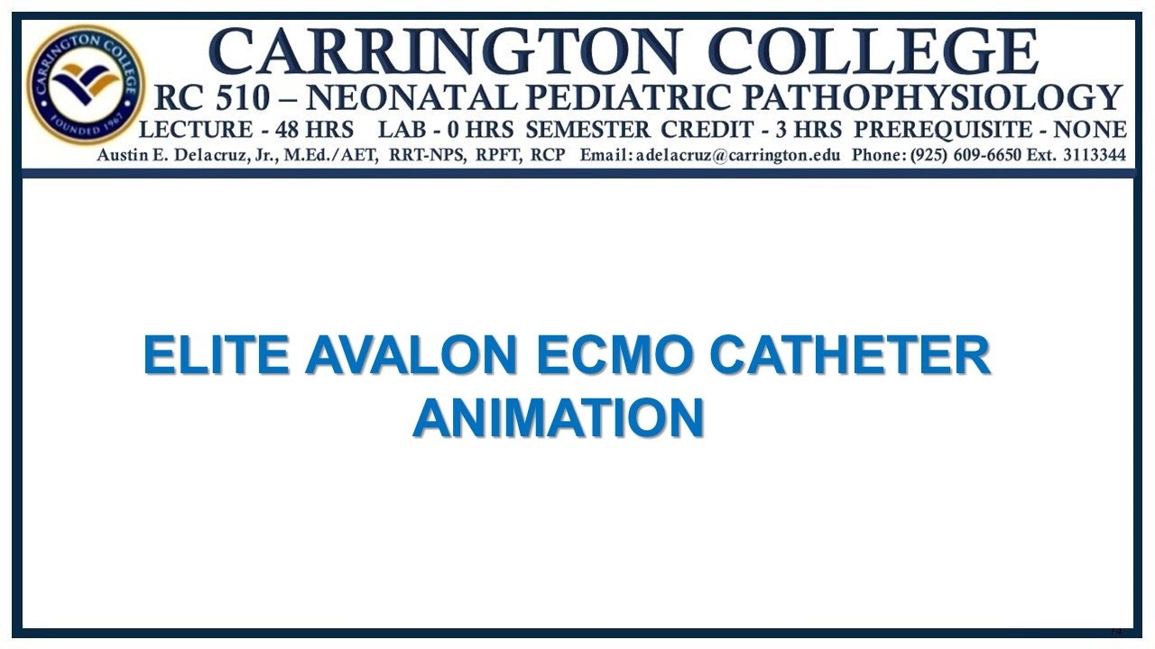 ELITE AVALON ECMO CATHETER