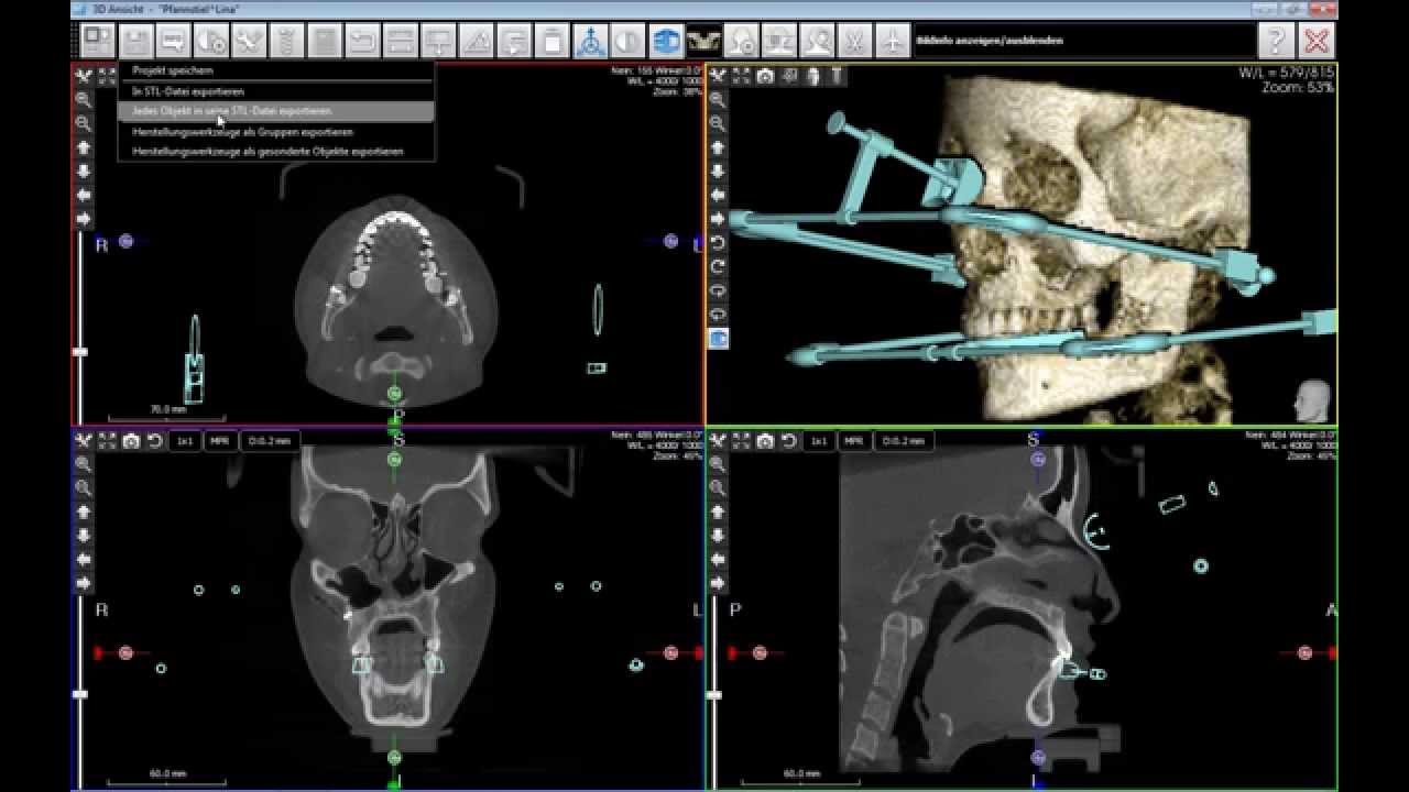 DORNMEDICAL GmbH - Bluefox Freecorder & 3Diemme 3Diagnosys