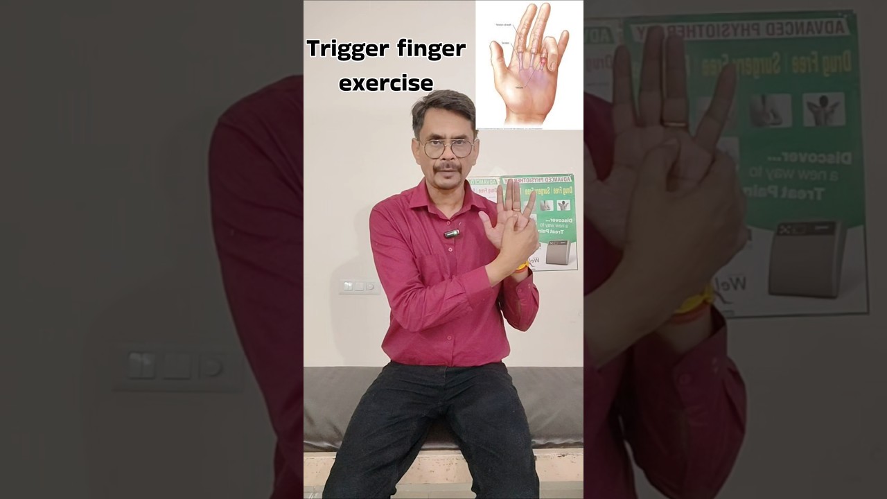 exercise for trigger finger | treatment for trigger finger