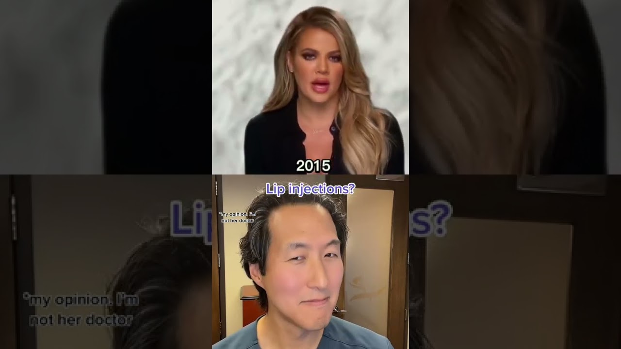 What Plastic Surgery Did Khloe Kardashian Get Over the Years? 
