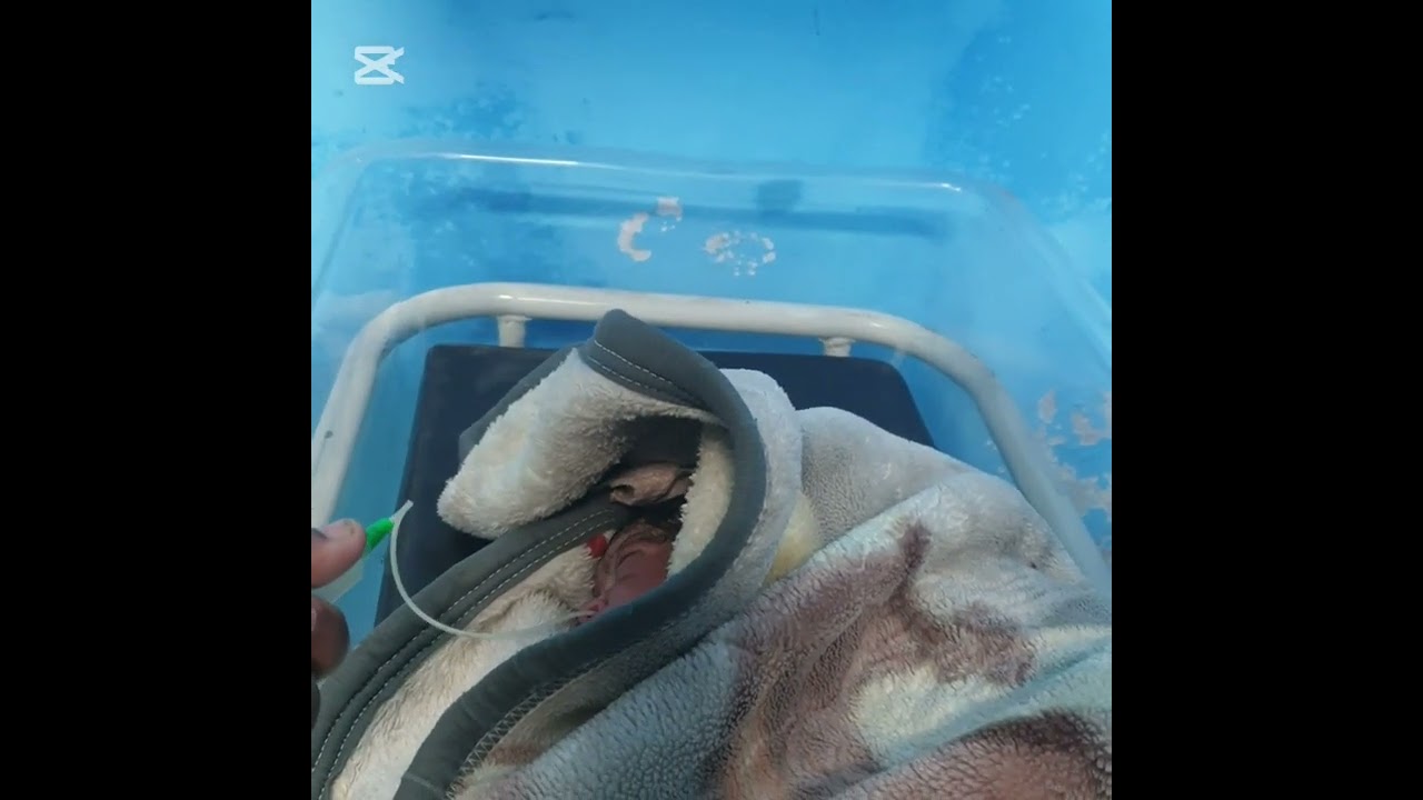 #baby#save life#10sec 