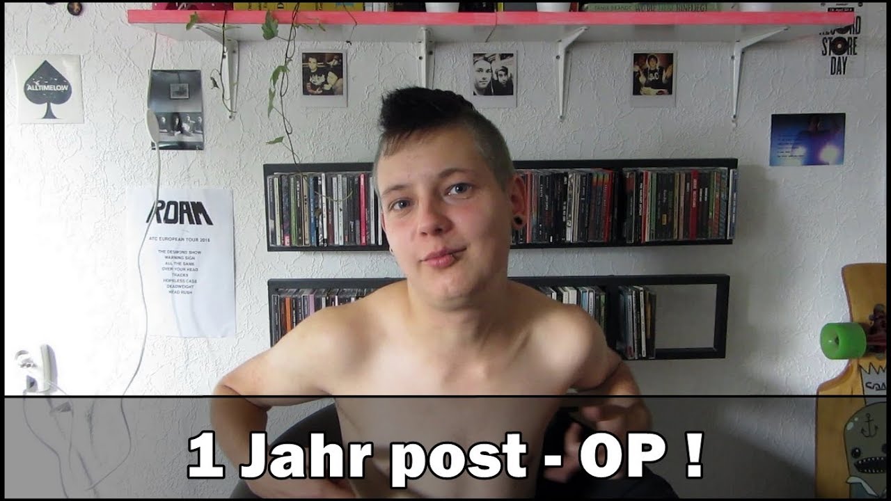 1 Jahr post OP!