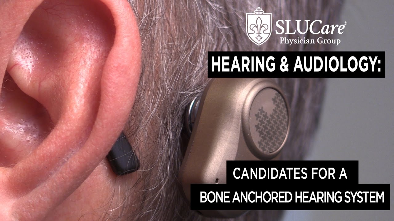 Who is right for a Bone Anchored Hearing System? - SLUCare Audiology