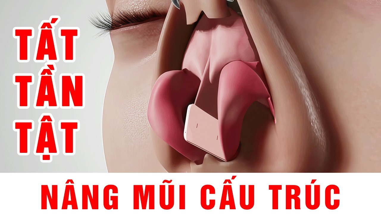 Nâng Mũi Cấu Trúc là gì ? (Giải đáp tất tần tật) | Bác Sỹ Hùng Thanh - Thẩm Mỹ GN