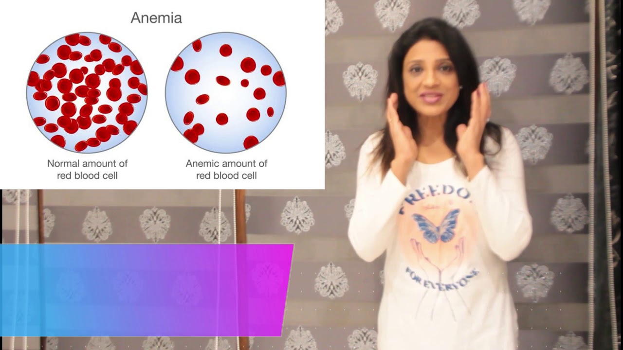 what is Hydrops fetalis ,how does the baby accumulate water inside its body