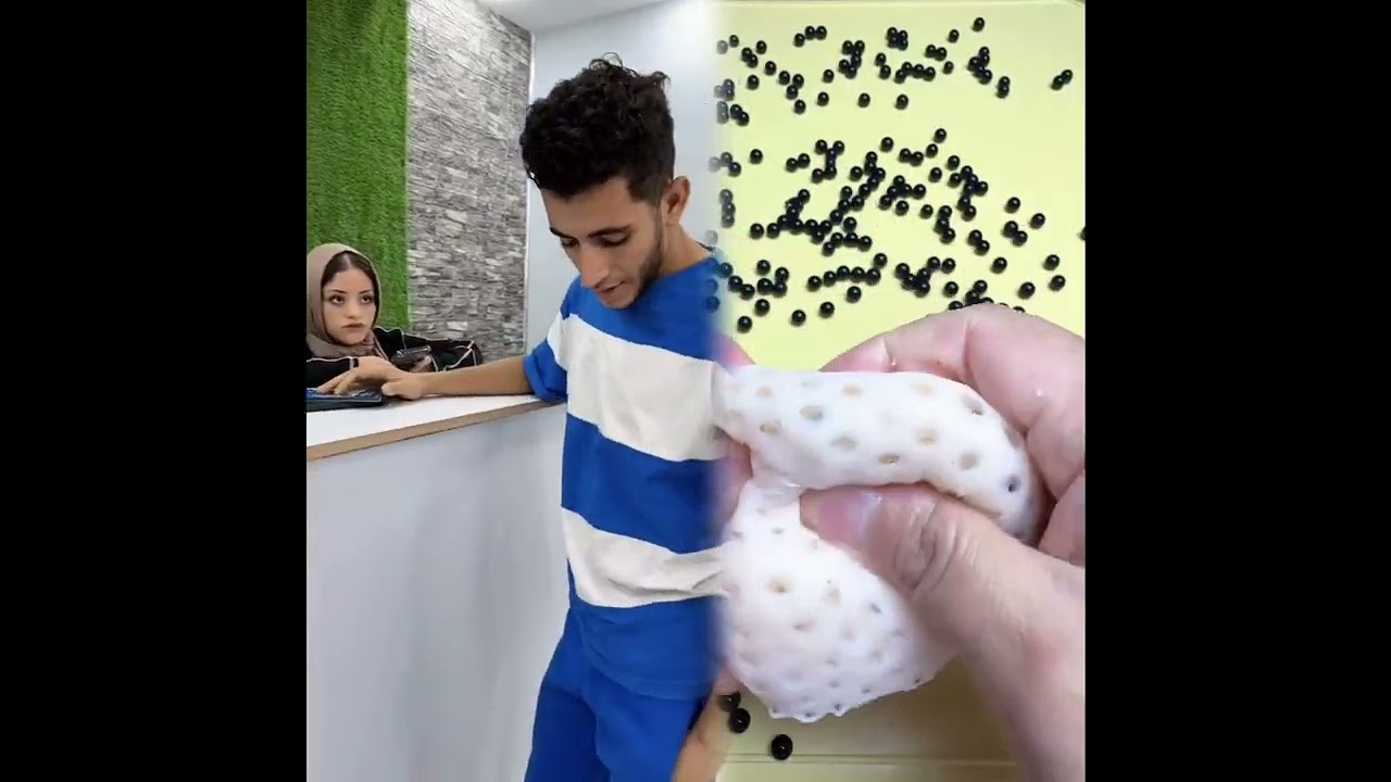 #الطفل الاعمى المعجزه #محضوره_من_الاكسبلور_والمشاهدات #علاوي_مارتن #اكسبلور 15_w🤣👌👌👌