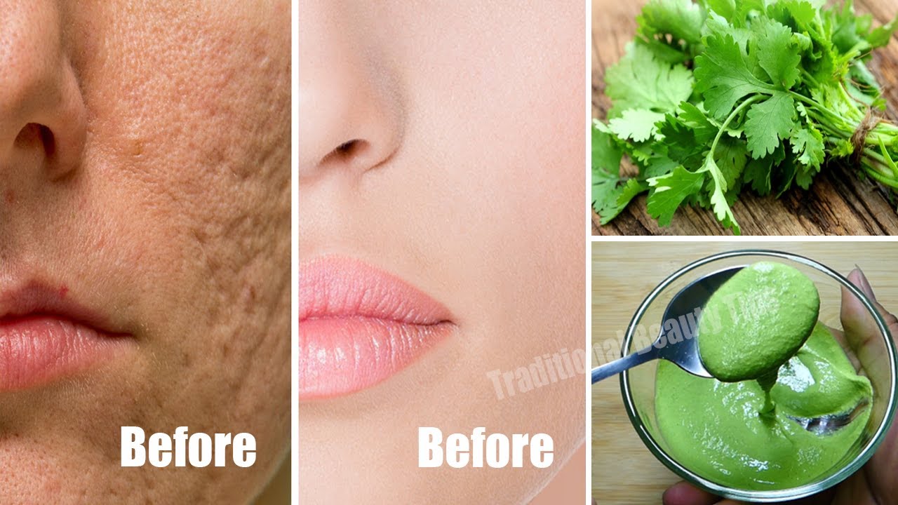 Apply Coriandre on Your Skin and See Magical Result within 1 Hour &brvbar;Amazing Coriandre Beauty Hacks