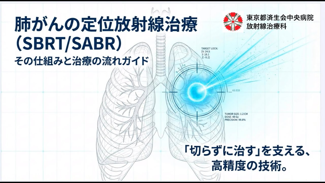 肺がん治療の選択肢、定位放射線治療（SBRT）の特徴と流れ｜東京都済生会中央病院