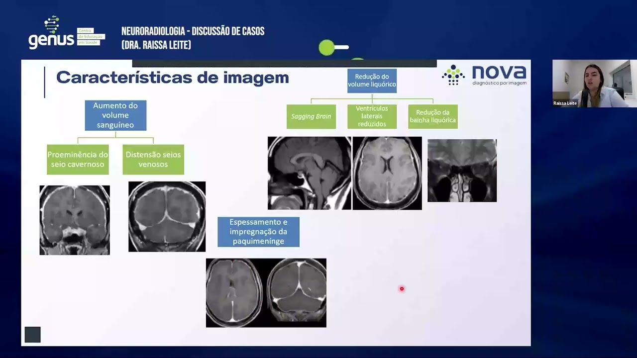 Webinar - Neuroradiologia - Discussão de Casos (Dra. Rayssa Nery)