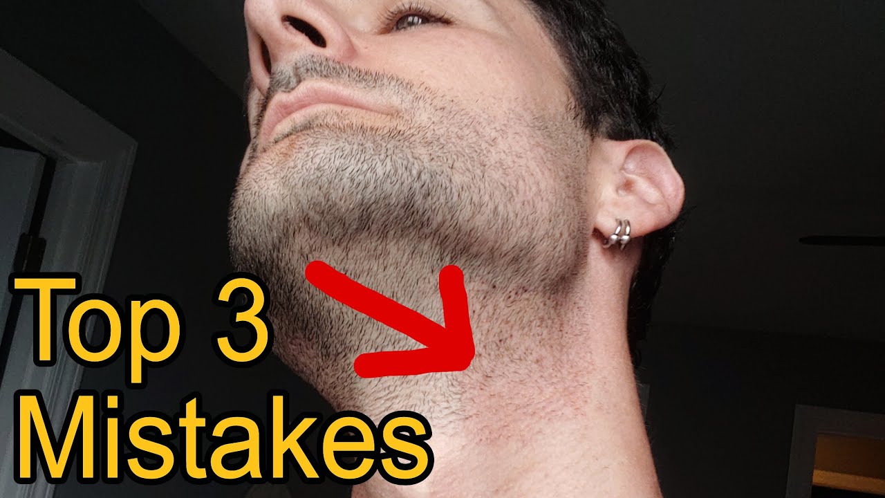Top 3 - Biggest Body Hair Transplant Mistakes!
