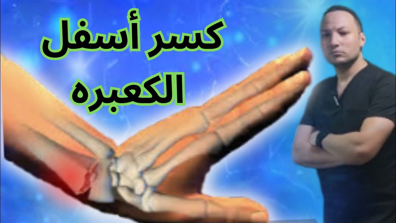 كسر اسفل  عظمة الكعبره في الكبار_كسر كوليز_كسر المعصم_كسر الرسغ