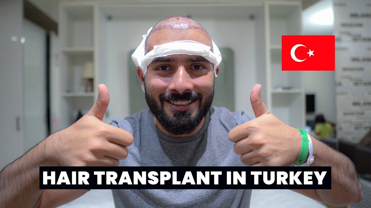 My Turkey Hair Transplant Surgery Experience | Complete Guide | FUE Hair Transplant in Turkey  🇹🇷