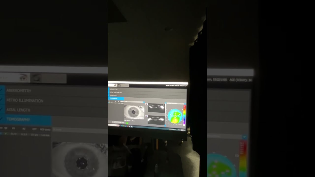 Operating the Oculus Pentacam AXL WAVE with CSP Pro scleral mapping