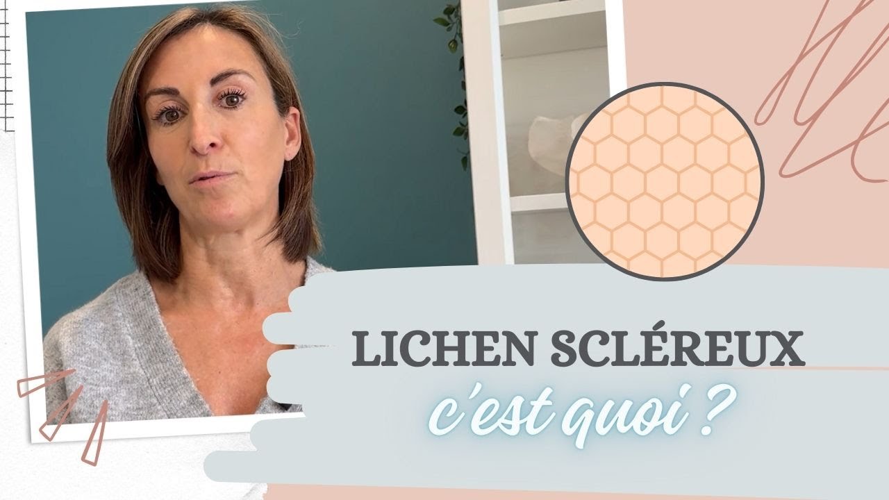 C'est quoi le lichen scléreux ?