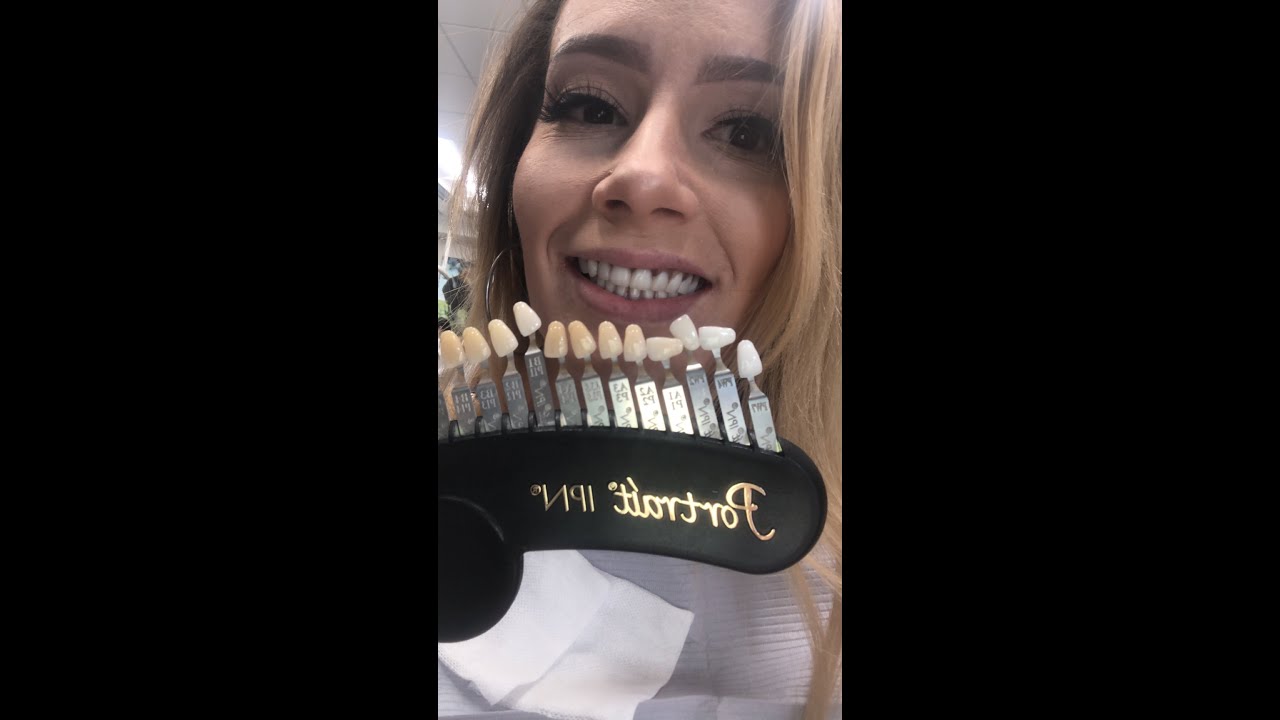 PICKING MY NEW TEETH? & Updates!