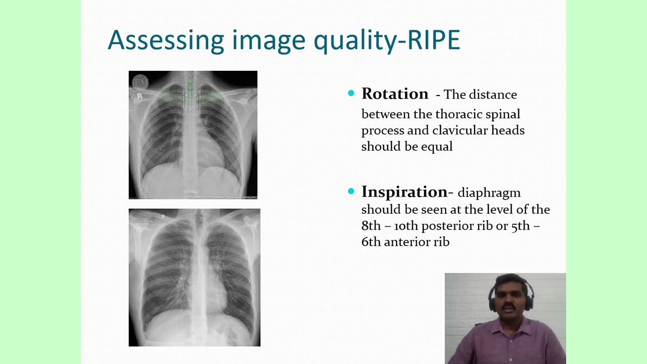 interpretation of chest X ray Dr  S  Prakash Babu