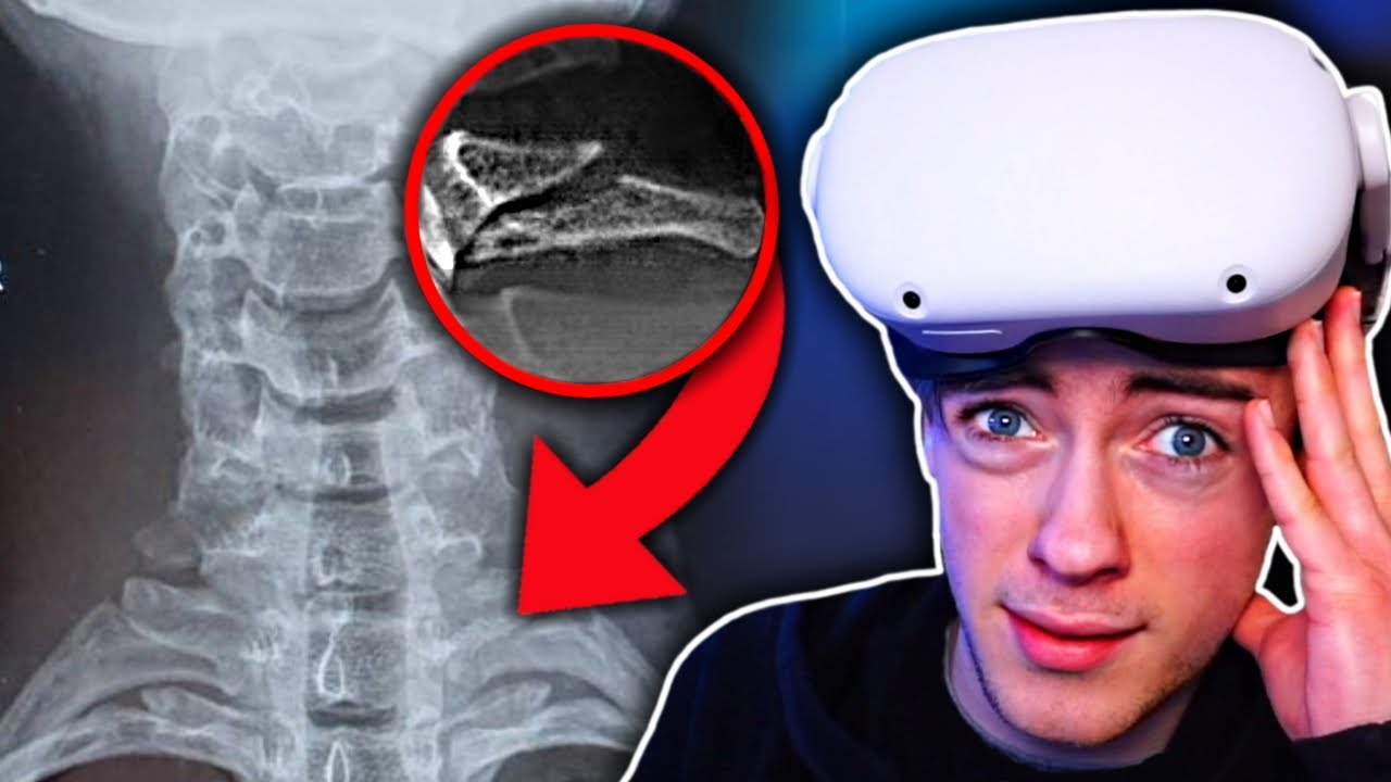 The Quest 2's WORST Injury Yet...