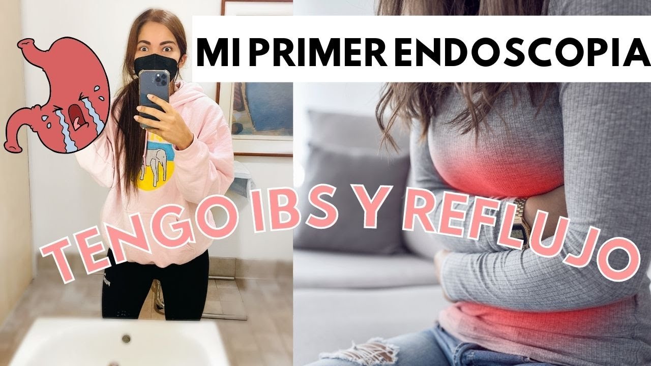 MI PRIMER ENDOSCOPIA ,diagnosticando REFLUJO y sindrome de colon Irritable. Tengo acidez estomacal!
